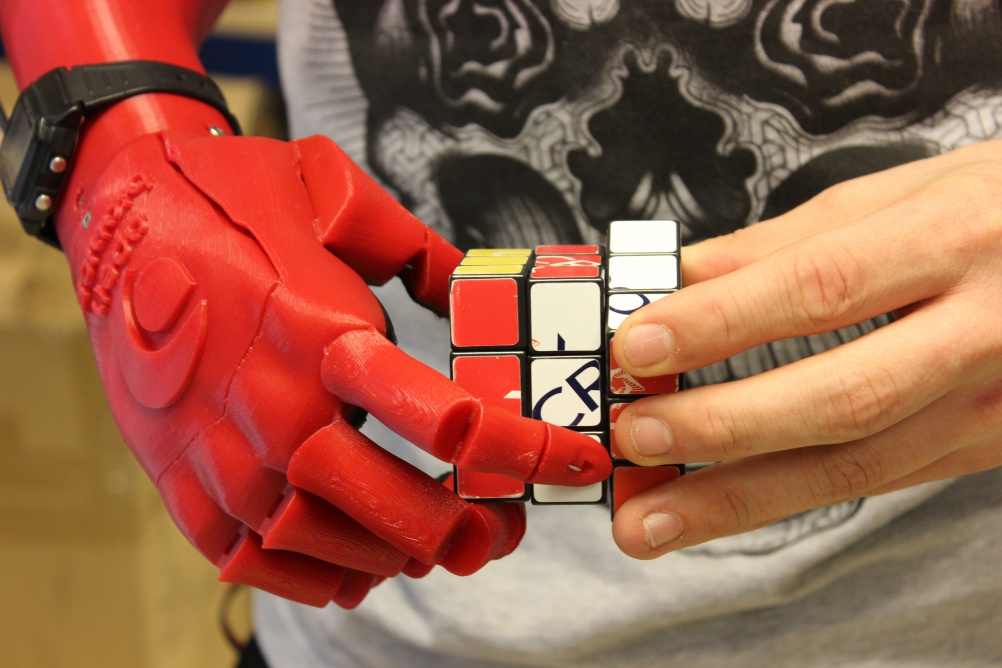 Dyson-award-robotic-bionic-hand